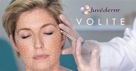 juvederm volite review|juvederm volux review.